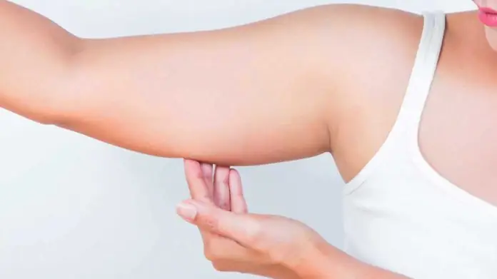 woman holding fat under arm